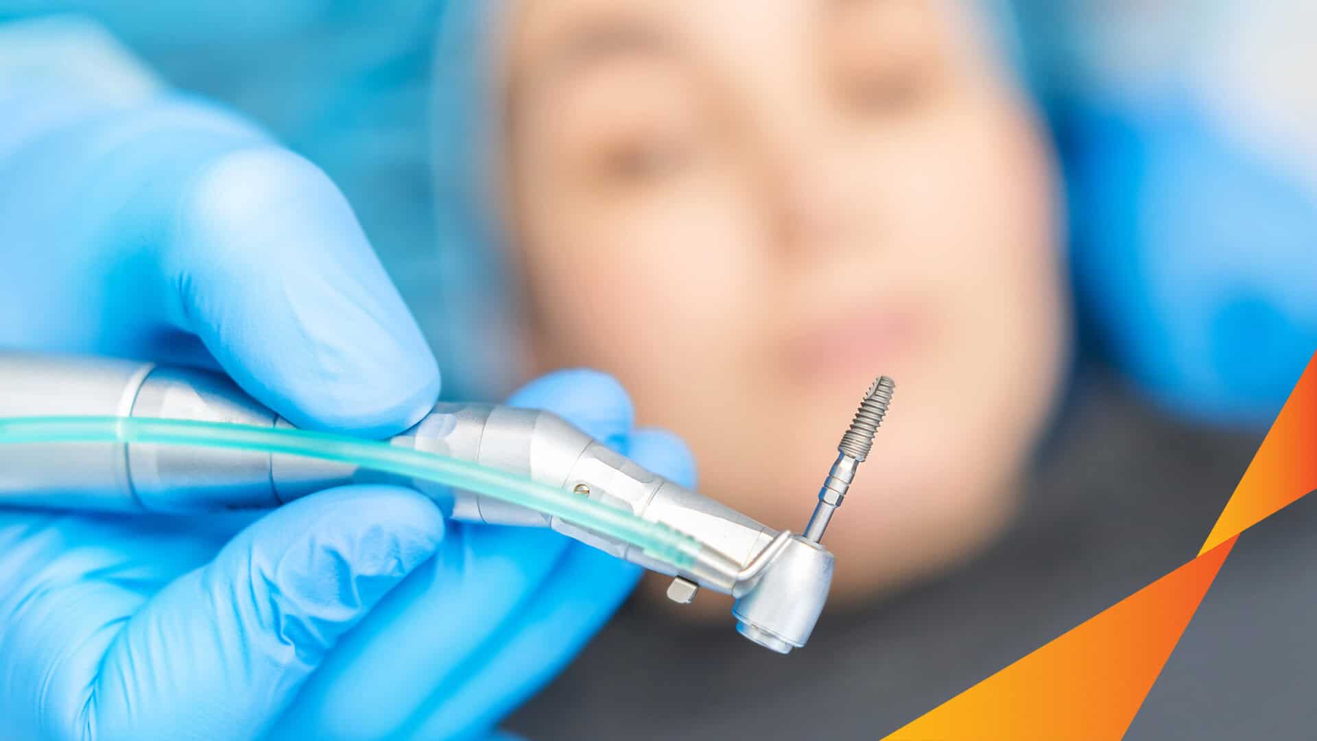 Nắn chỉnh răng ngầm