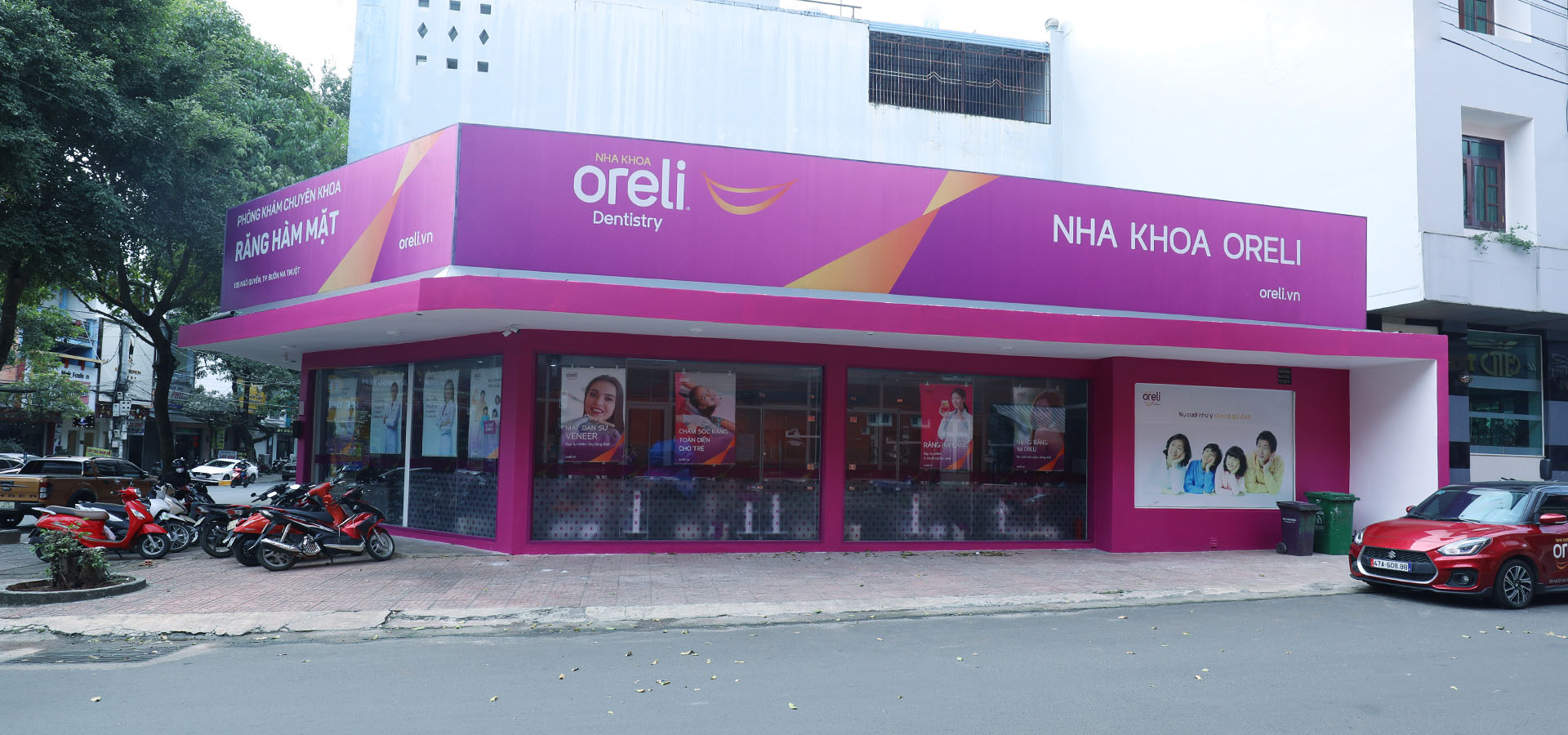 Câu hỏi cấy ghép nha khoa All-on-4