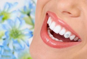 đính đá lên răng