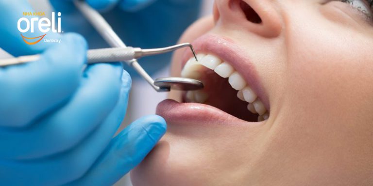 rang implant nha khoa oreli