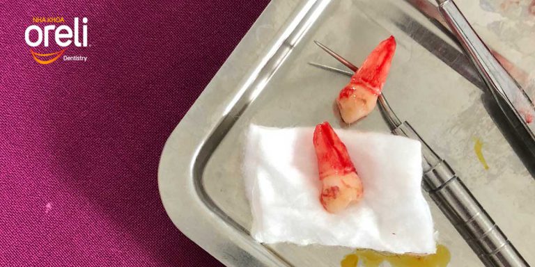 nieng rang khon nho rang