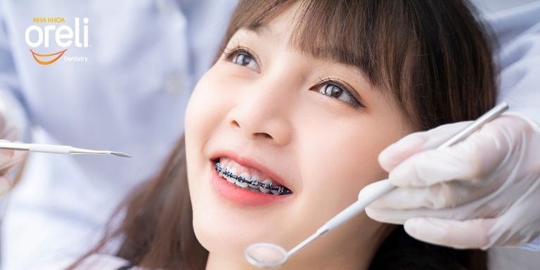 nieng rang uy tin buon ma thuot