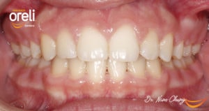 nieng rang chinh nha uy tin daklak bmt