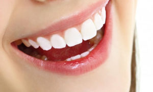 Cắt nướu gọt xương làm dài thân răng lâm sàng