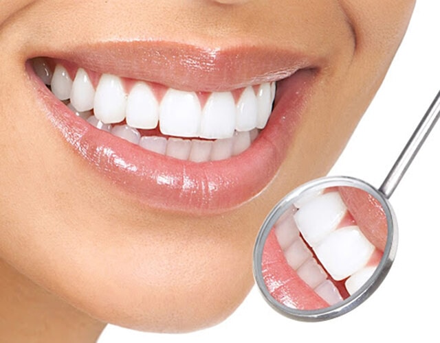 Trám răng phục hồi trực tiếp