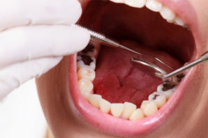 Tủy răng – Những gì mong đợi