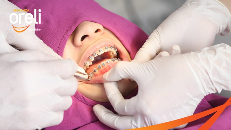 nieng rang mac cai tu buoc