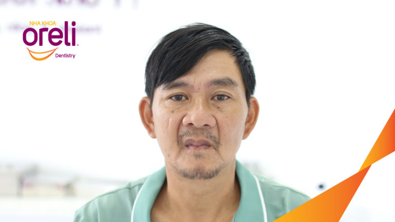 Tiêu xương hàm dưới sát ống thần kinh có trồng răng được không ? – Kết quả tại Oreli
