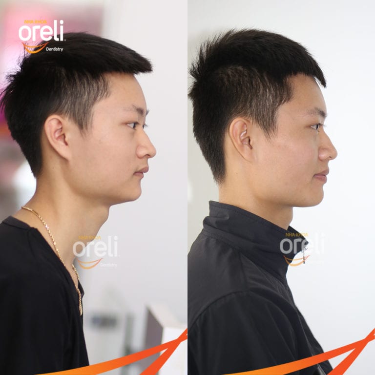 nieng rang bmt daklak