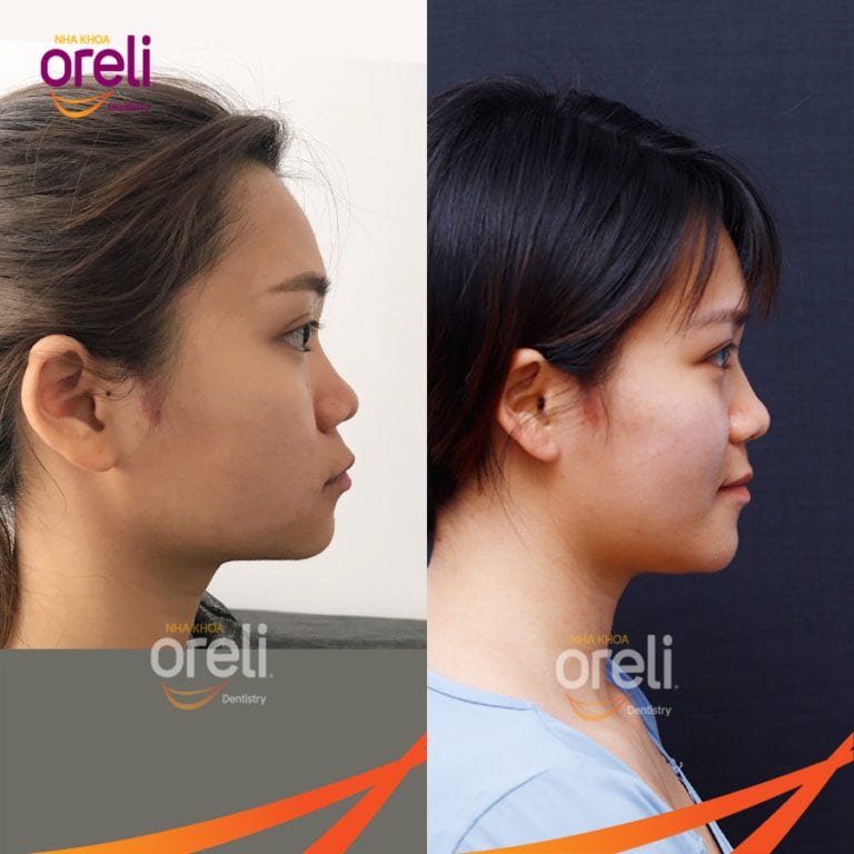 Nieng rang uy tin gia re o daklak