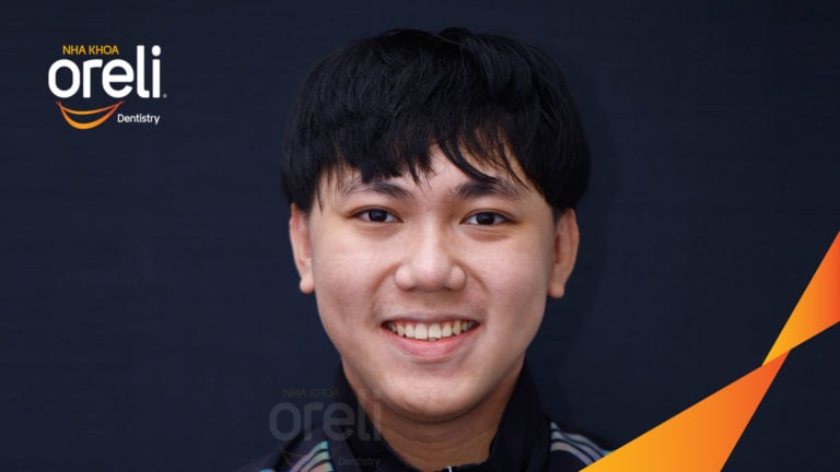 Ca niềng chỉnh hô thay đổi góc nghiêng đẹp kết quả thực tế tại Oreli