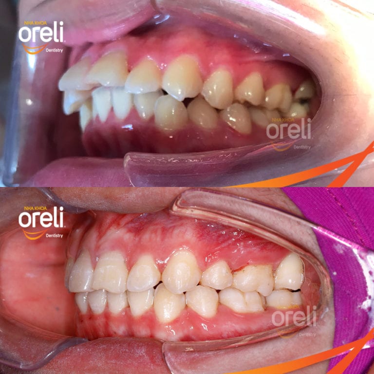 nieng rang ho uy tin daklak