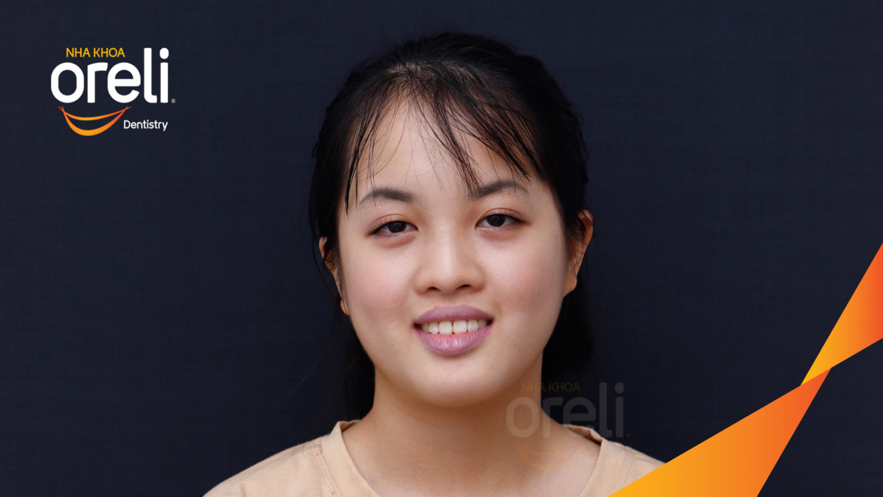  trước khi điều trị tại Oreli