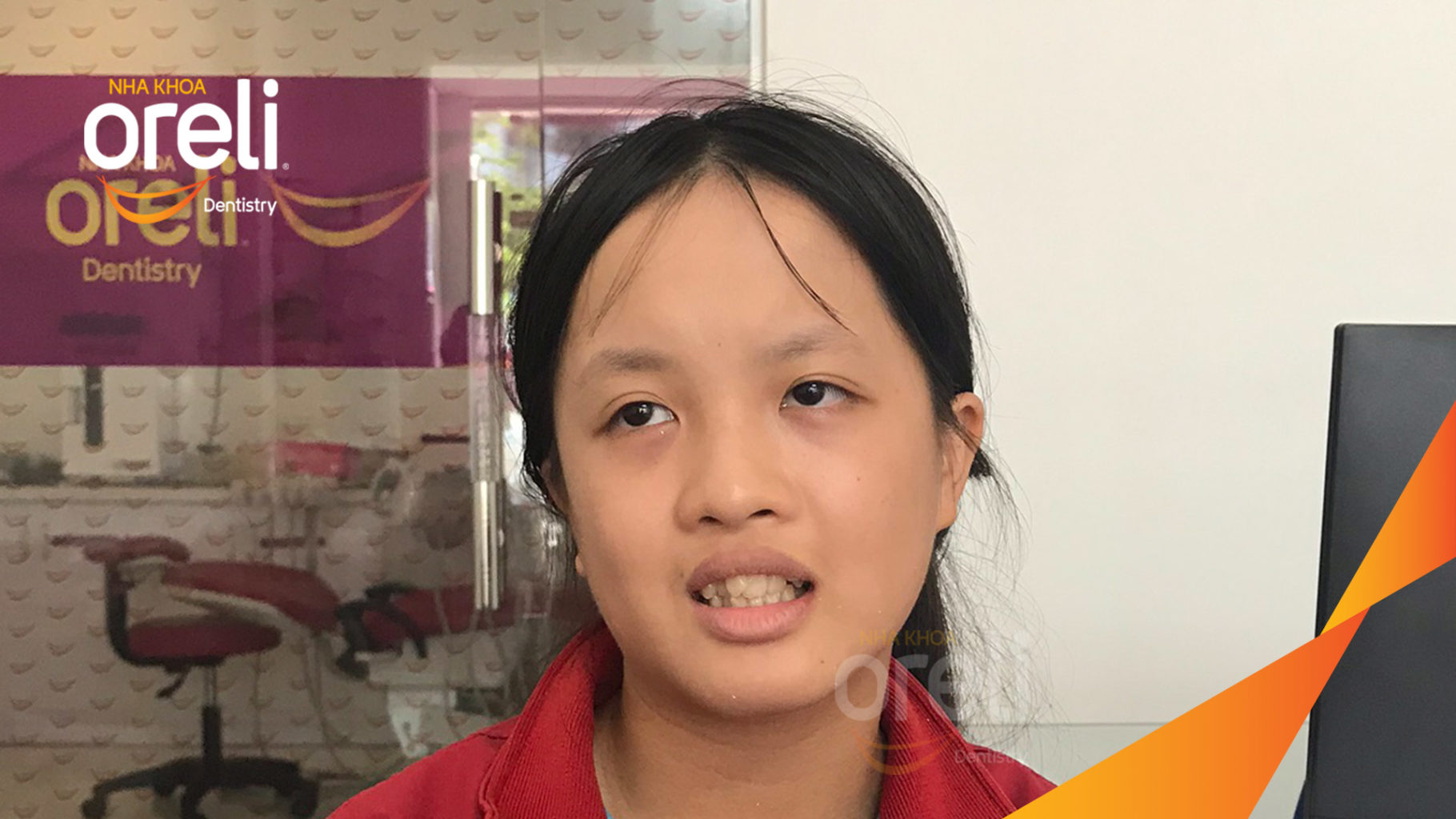 Trước điều trị:  tại Oreli