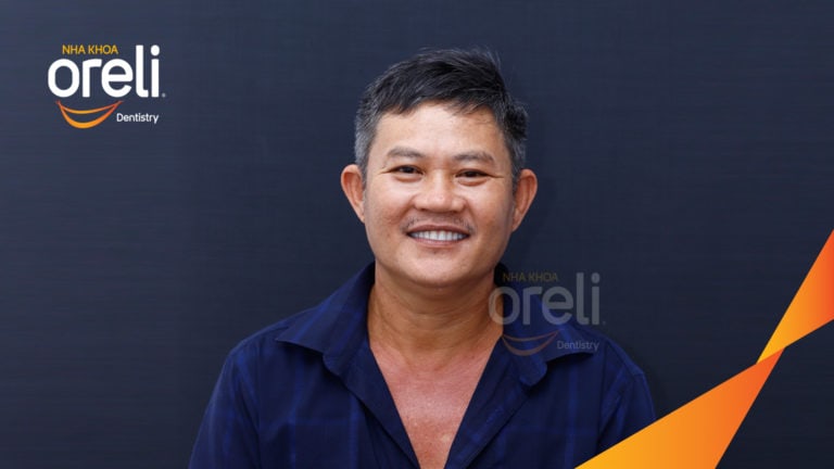 cay ghep implant toan ham