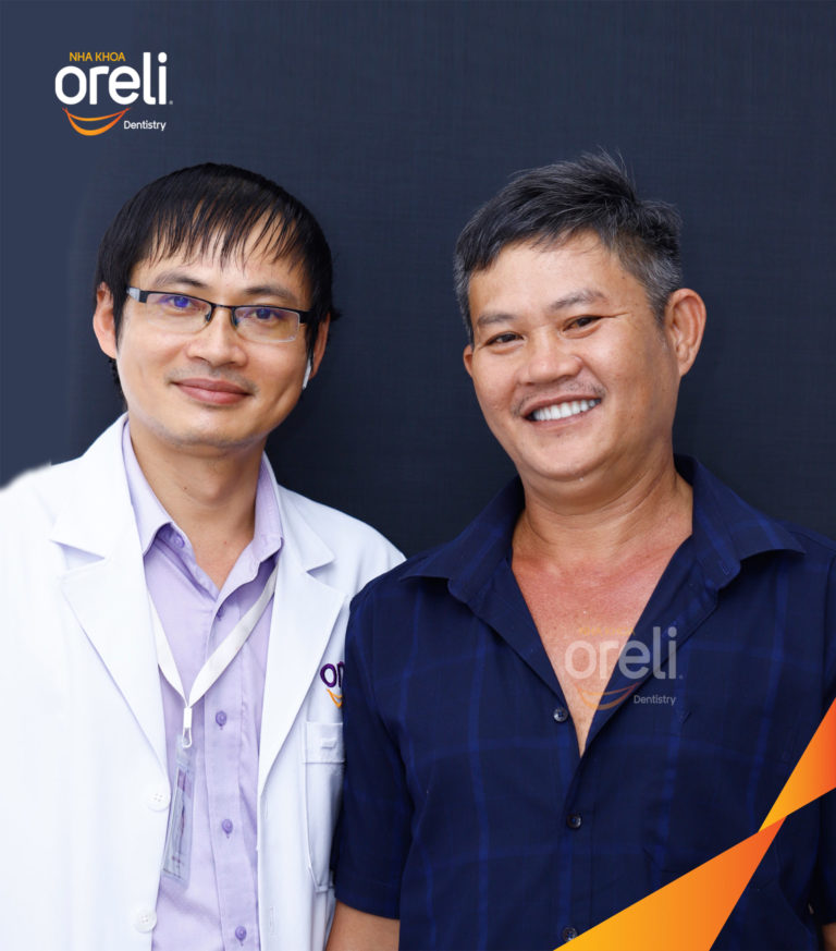 Kết quả trồng răng Implant hàm trên – Khôi phục chức năng ăn nhai | Oreli
