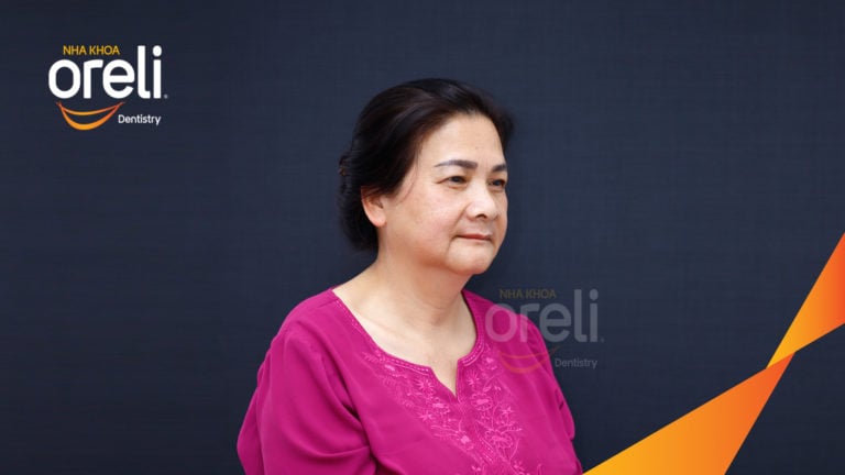 Trồng răng hàm trên và hàm dưới bằng Implant | Kết quả thực tế tại Oreli