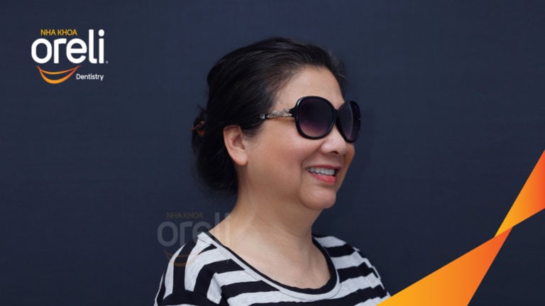 Trồng răng hàm trên và hàm dưới bằng Implant | Kết quả thực tế tại Oreli
