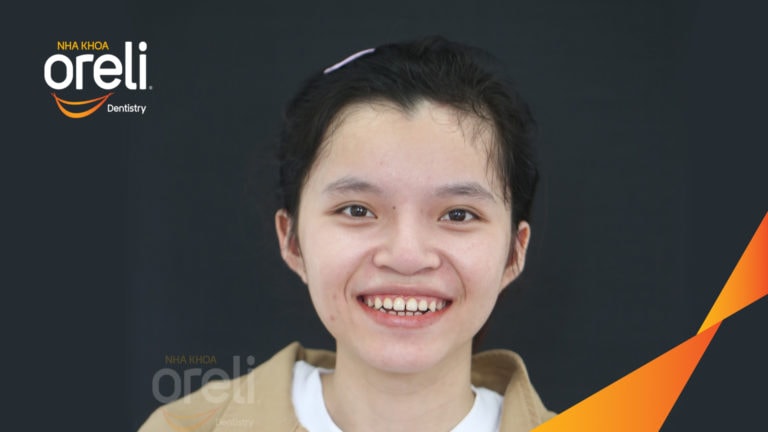 nieng rang uy tin oreli bmt daklak