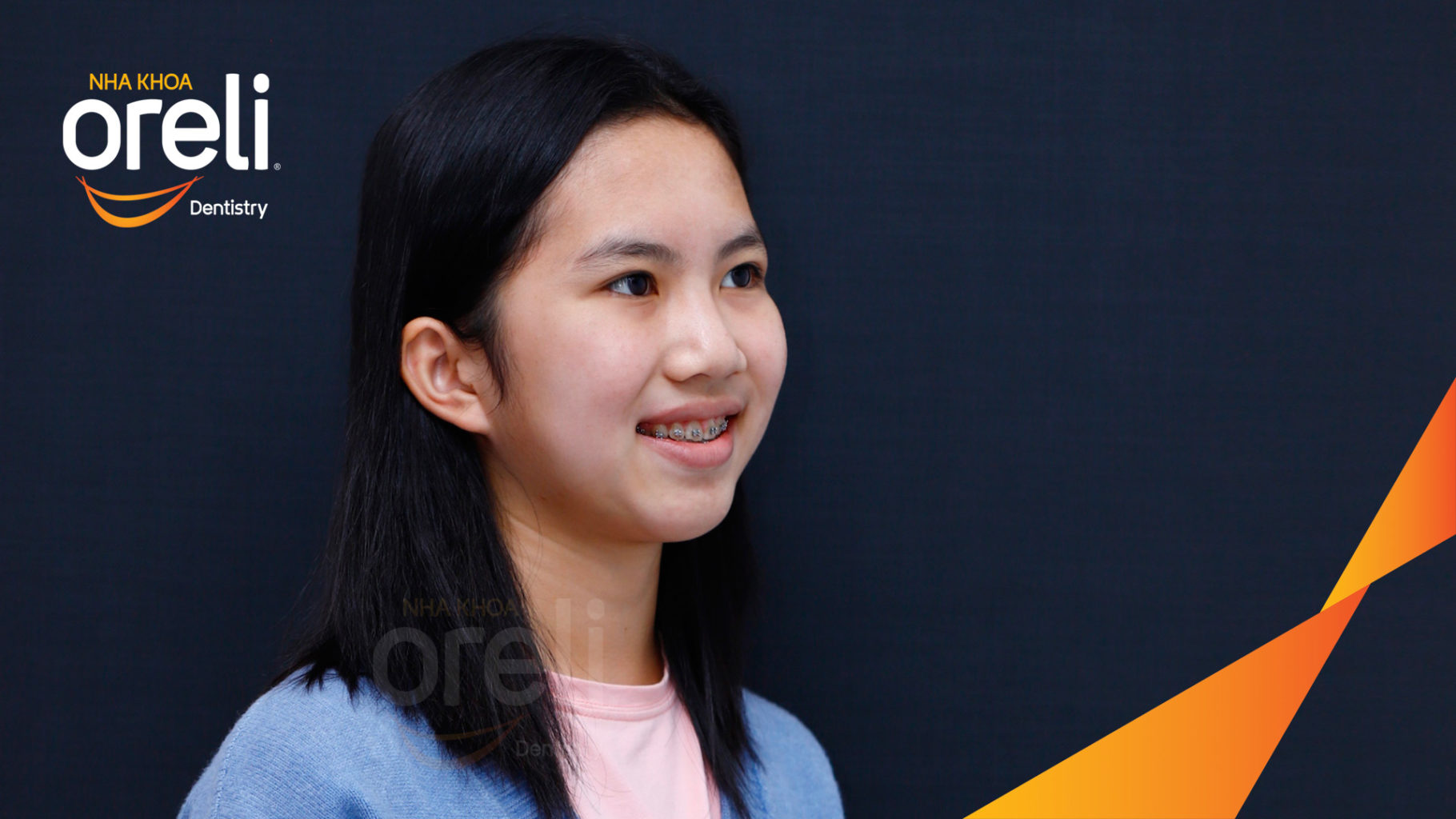 nieng rang ho uy tin bmt daklak nha khoa oreli