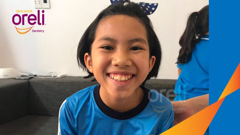 nieng rang ho uy tin bmt daklak nha khoa oreli