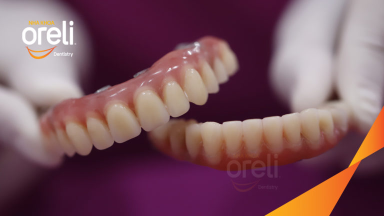 Kết quả Implant hai hàm – Khôi phục răng mất hiệu quả | Oreli
