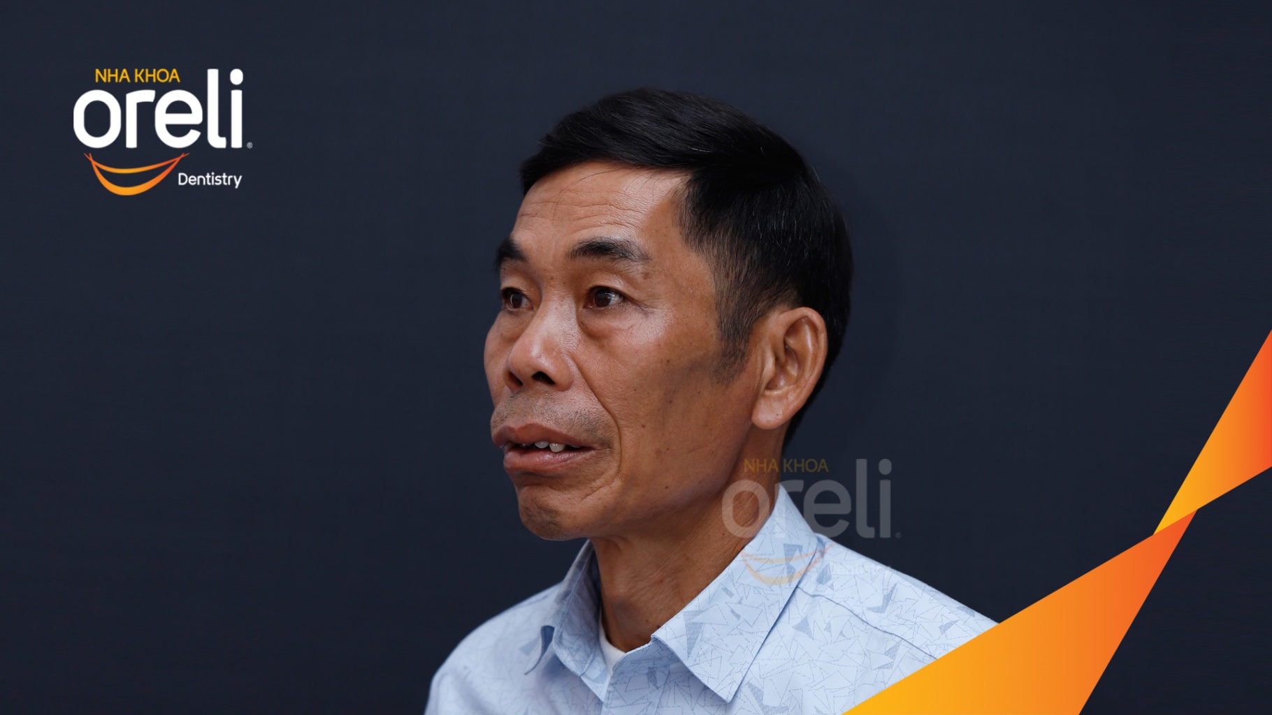 Ca trồng răng Implant chỉnh hô hai hàm tại Oreli