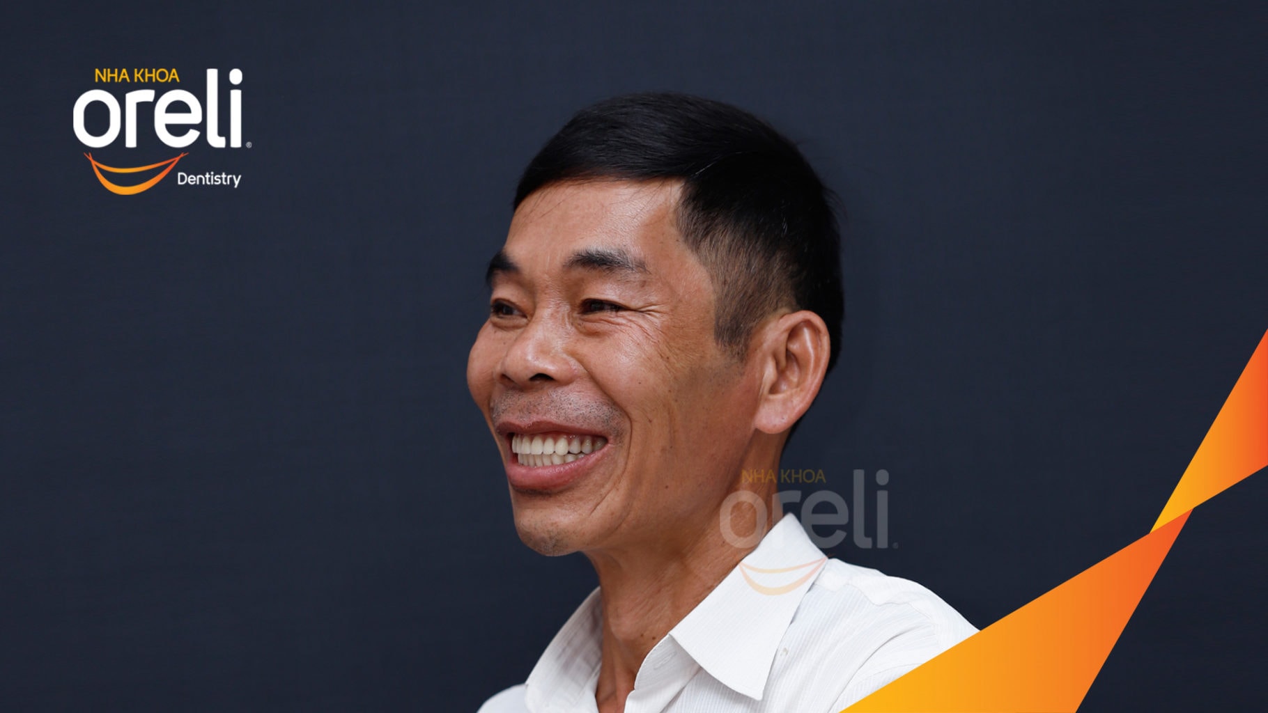 Ca trồng răng Implant chỉnh hô hai hàm tại Oreli