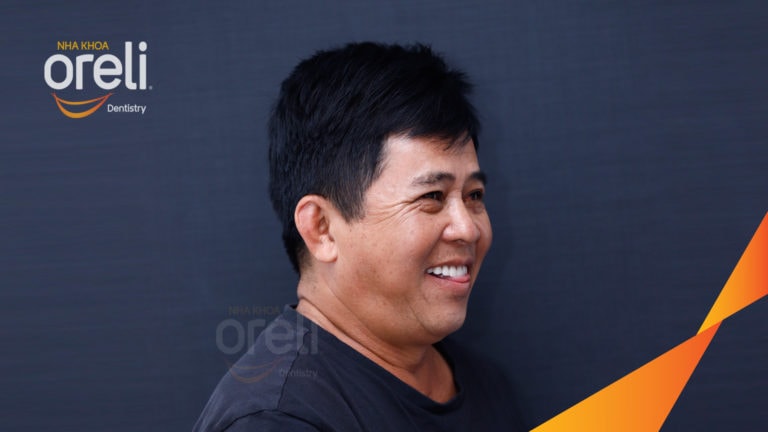 cay ghep toan ham implant oreli