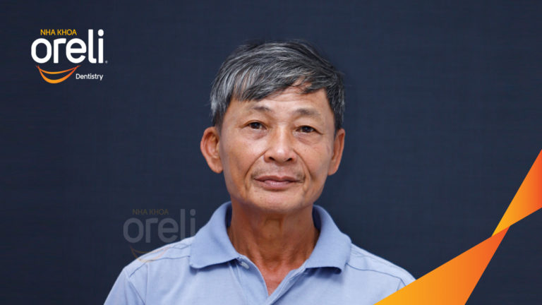Ca trồng răng hai hàm giải quyết tình trạng tiêu xương trầm trọng – Ổn định ăn nhai và thẩm mỹ | Oreli