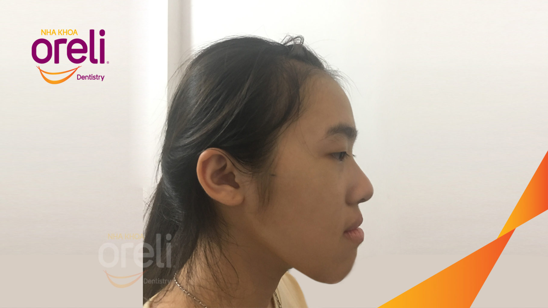 Quá trình  trong  tại Oreli