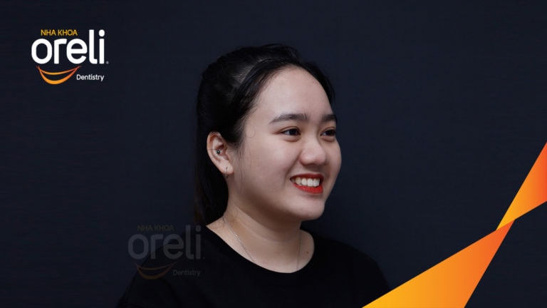 nieng rang uy tin buon ma thuot