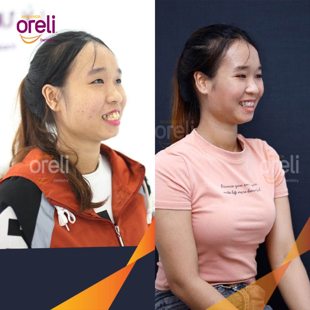 Kết quả sau :  tại Oreli