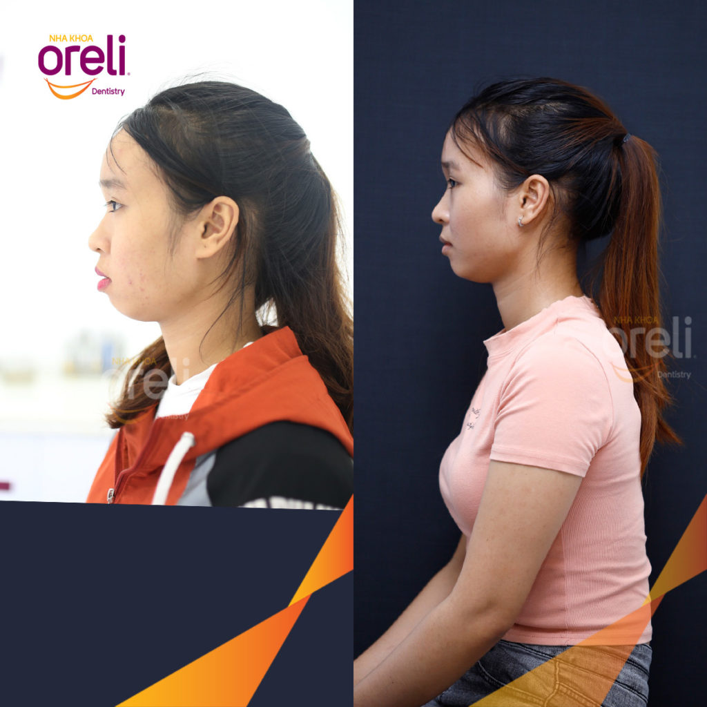 Quá trình  trong  tại Oreli