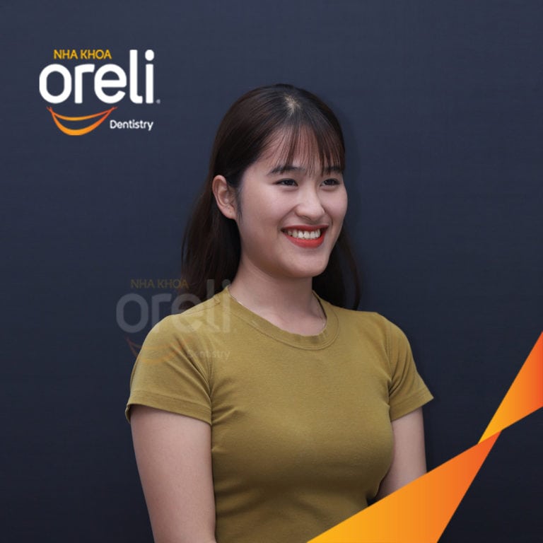 Ca niềng chỉnh móm chen chúc nặng hai hàm kết quả thay đổi nụ cười khuôn mặt tại Oreli