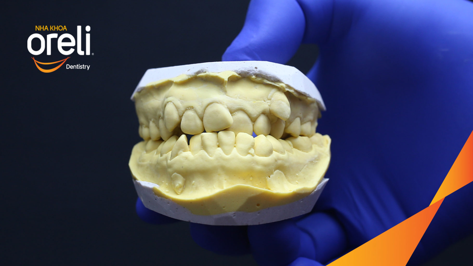  trước khi điều trị tại Oreli