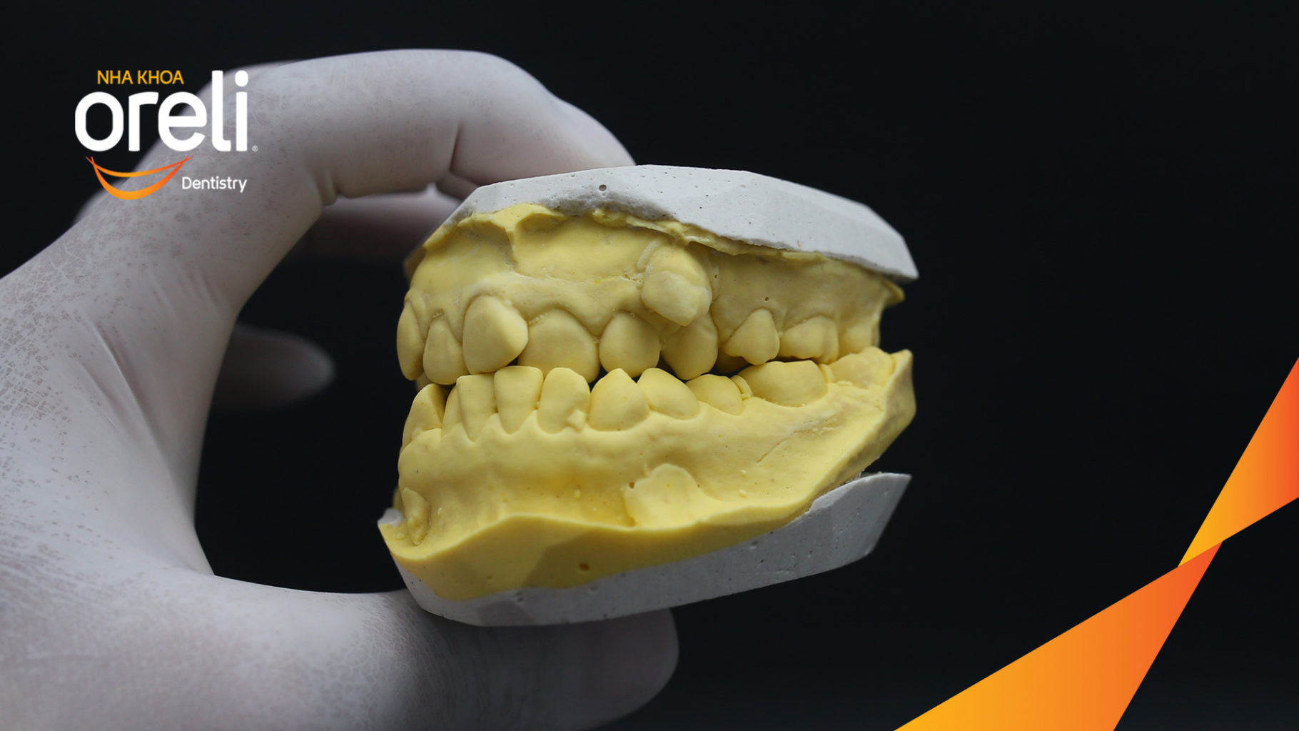 Trước điều trị:  tại Oreli