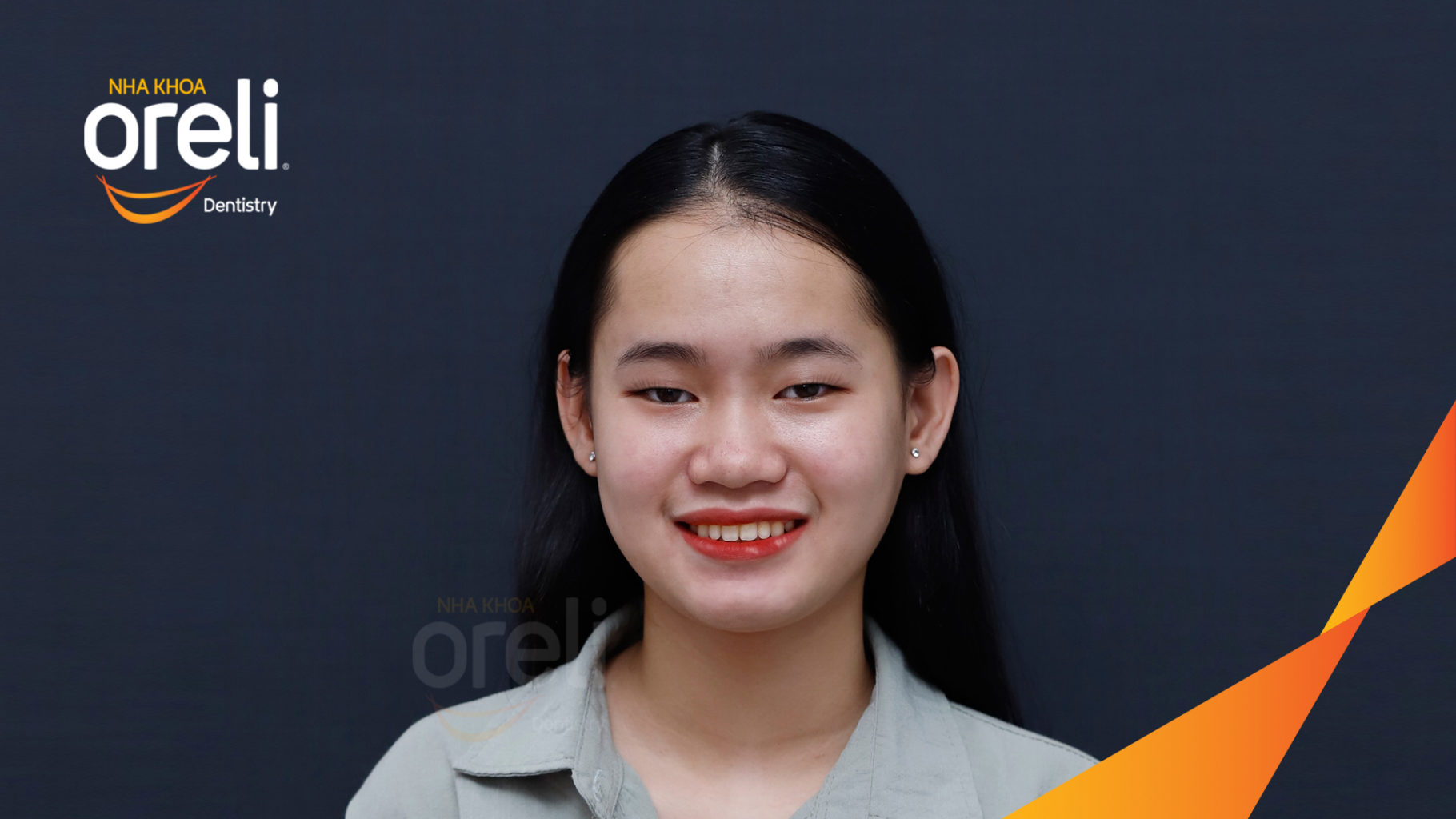  trước khi điều trị tại Oreli