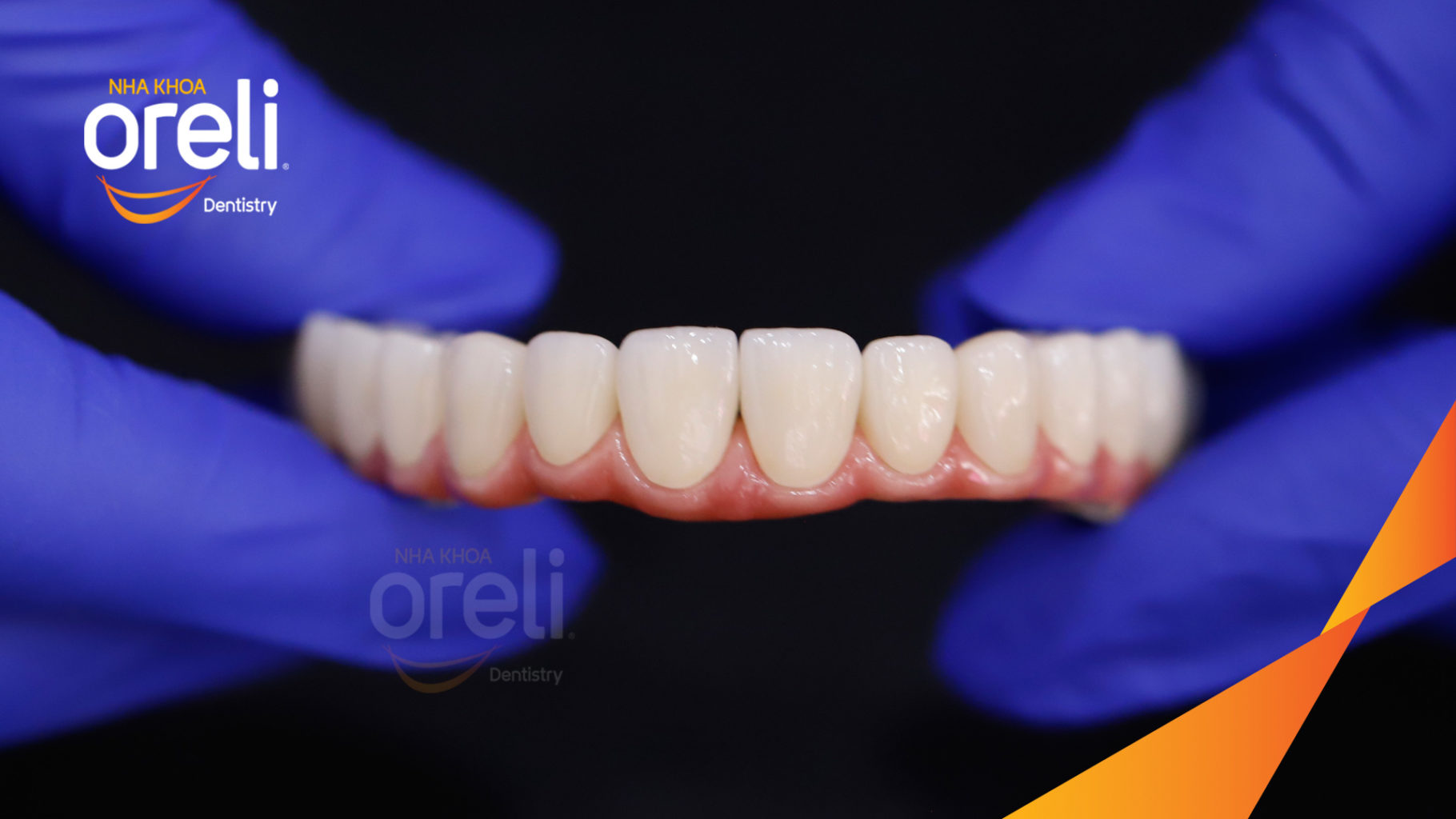 Kết quả đạt được sau  -  tại Oreli