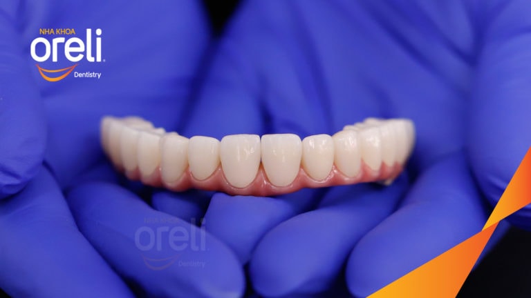 cay ghep implant oreli