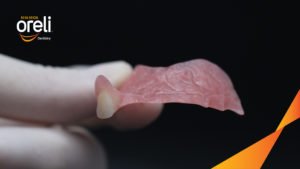 Răng giả & răng giả một phần