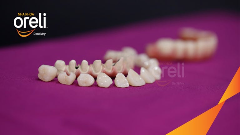 cay ghep implant oreli