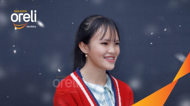 Ca niềng chỉnh hạng 3 móm nặng với kỹ thuật GEAW- Kết quả sau 24 tháng tại Oreli