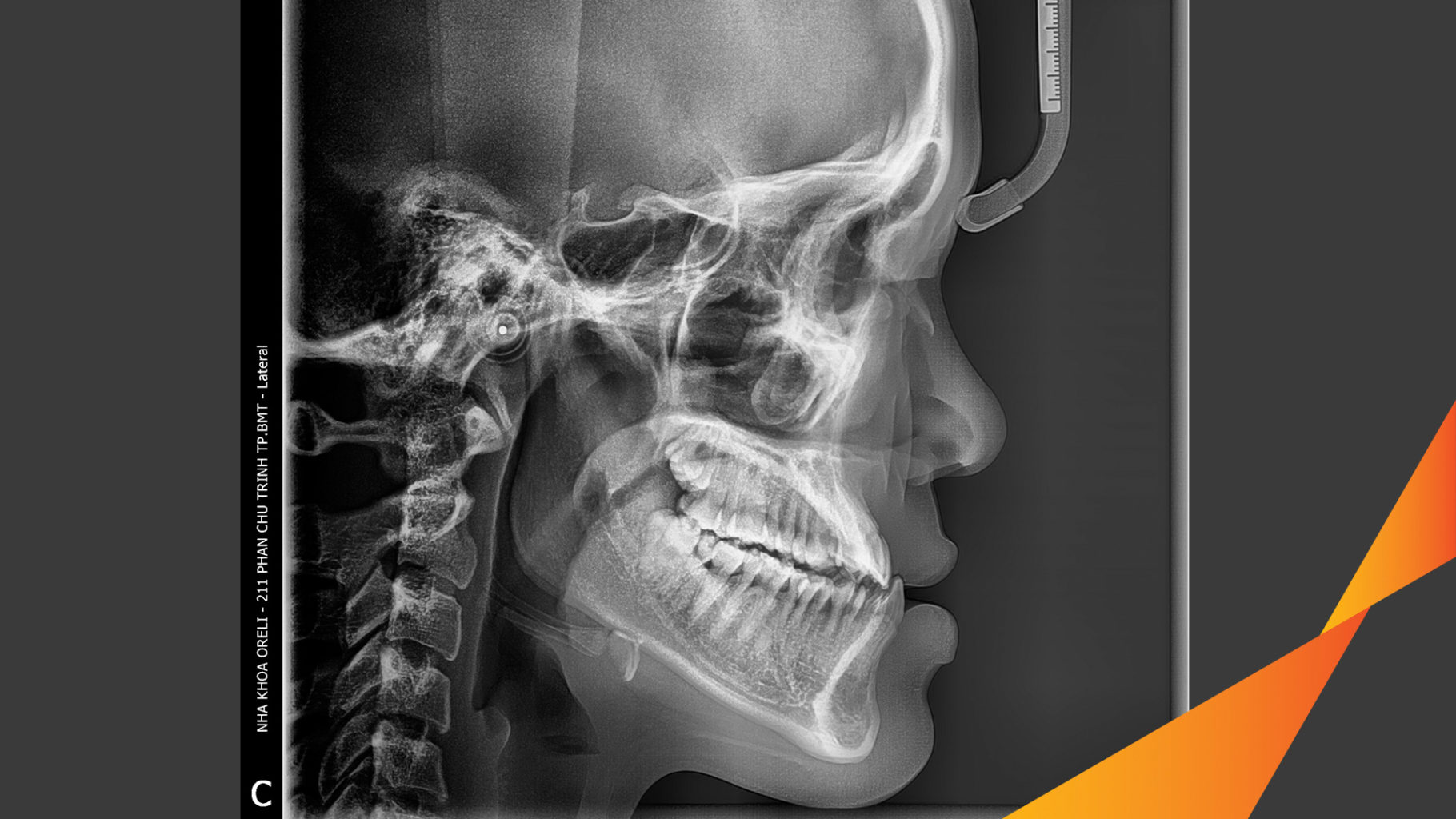 nieng rang uy tin bmt daklak