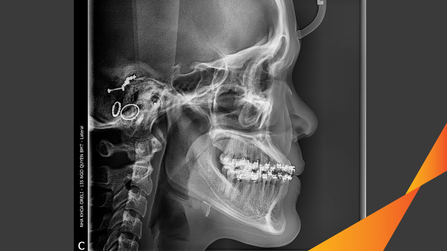 nieng rang uy tin bmt daklak