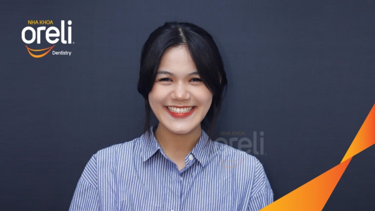 Ca chỉnh móm nặng không nhổ răng cho nụ cười đẹp và khớp cắn đúng tại Oreli