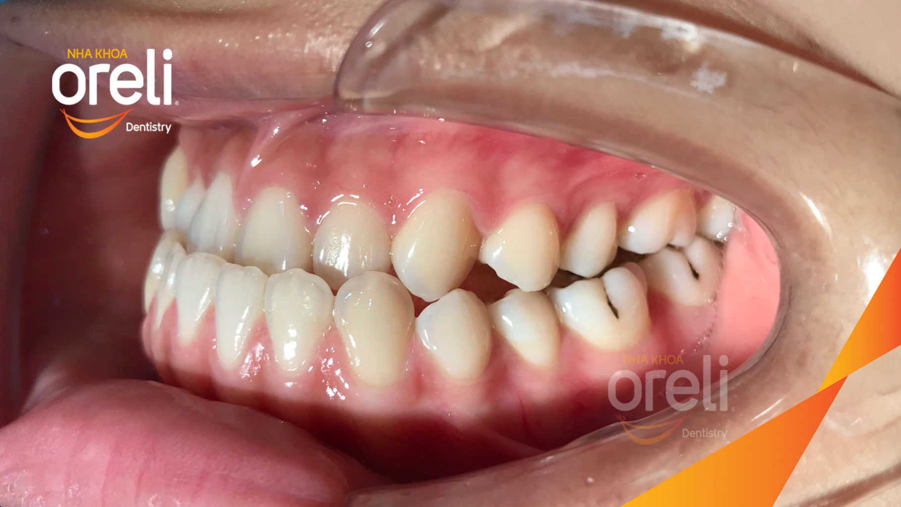 nieng rang uy tin bmt daklak