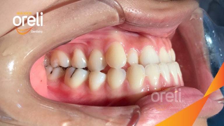 nieng rang uy tin bmt daklak