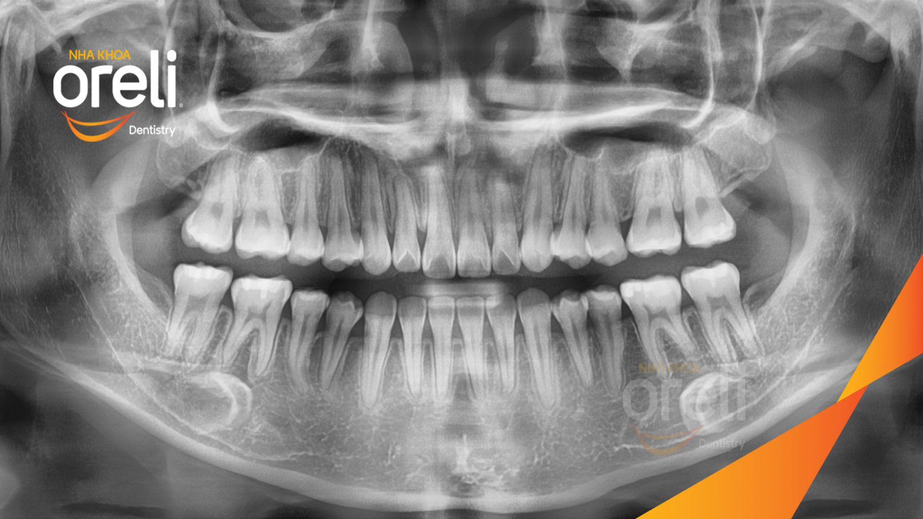 nieng rang uy tin bmt daklak