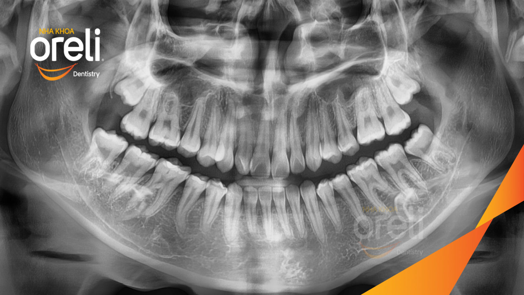 nieng rang uy tin bmt daklak